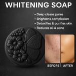 Shalma Naturals brightening charcoal soap